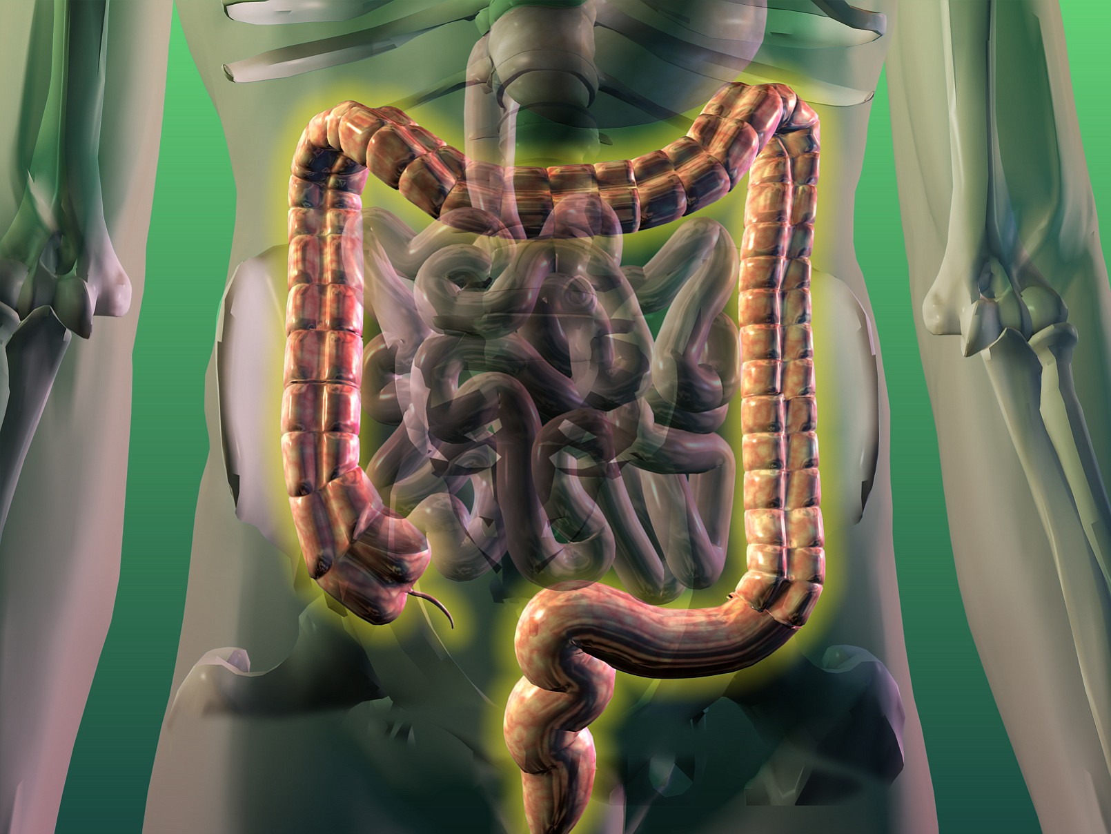 McClatchy-Tribune files
Colon cancer is cancer of the large intestine, or colon, which is the lower part of the digestive system. Rectal cancer is cancer of the last several inches of the colon. Together, they're often referred to as colorectal cancer.