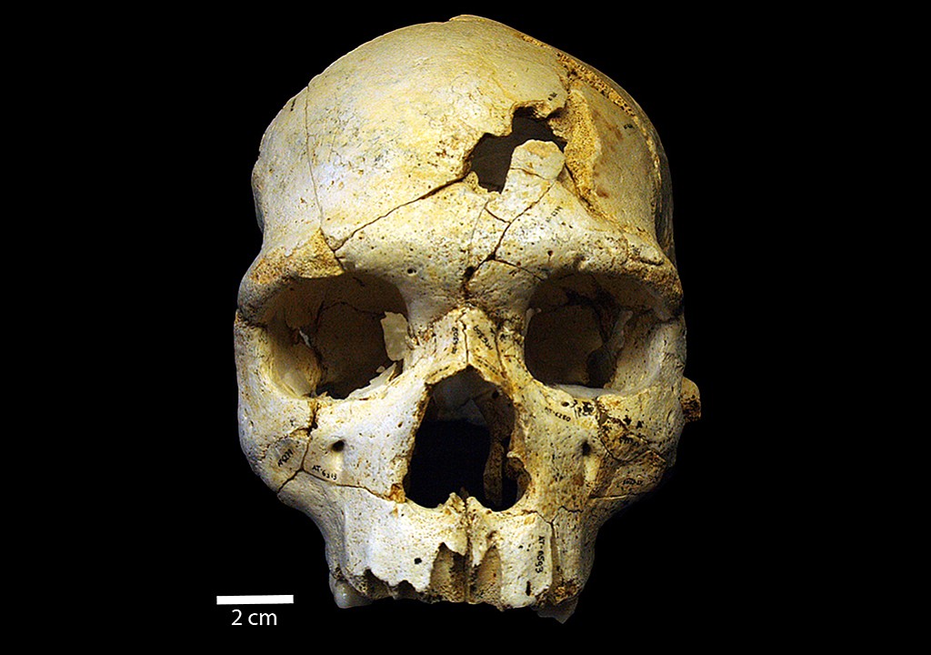 PLOS One
This is the frontal view of Cranium 17, a skull that was discovered in a mass grave in Spain. Scientists say it may show evidence of the world's oldest recorded murder. The skull has two lethal injuries that were likely caused by another human.