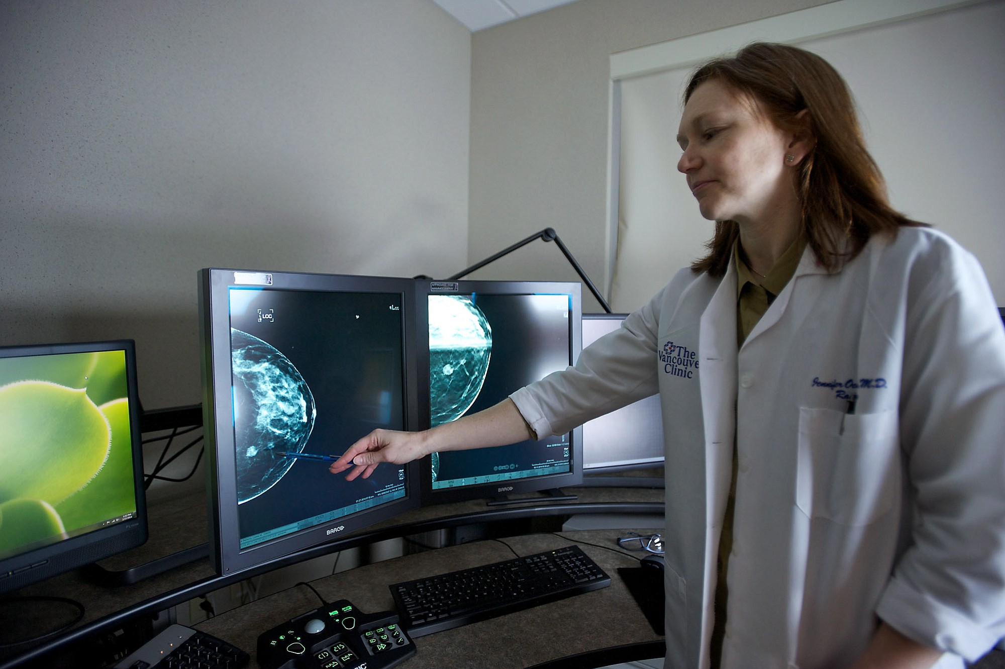 Dr. Jennifer Ochsner reviews the mammogram of a 50-year-old woman diagnosed with breast cancer at the Vancouver Clinic's Breast Care Center in February.