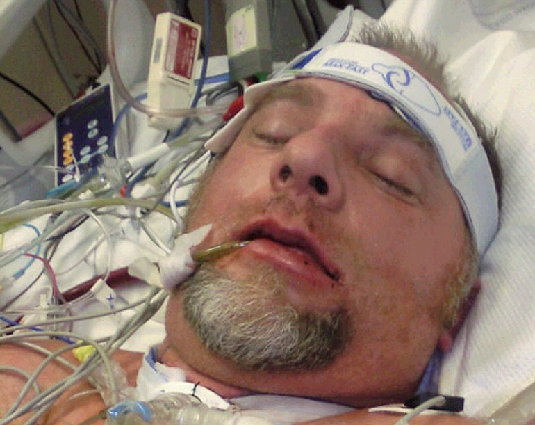 Tom Trautman is battling H1N1 at Legacy Emanuel intensive care in Portland.
