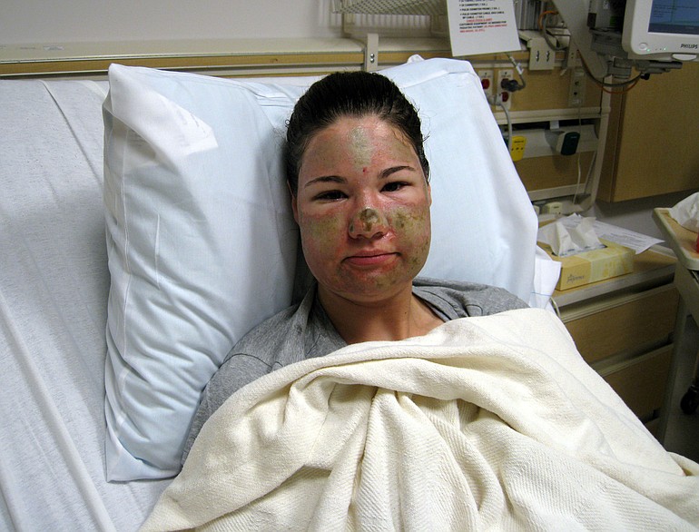 Legacy Health released this photo of Bethany Storro taken after the Monday attack near Esther Short Park.