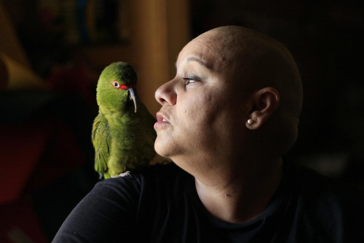 Cecilia Heyder, 47, who has systemic lupus and breast cancer, poses with her pet bird at her home in Santiago, Chile.