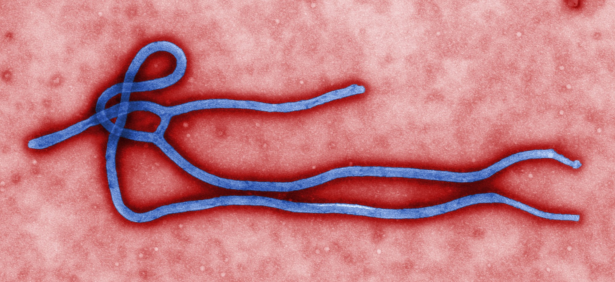 This undated file image made available by the Centers for Disease Control shows the Ebola virus. In a second, smaller Ebola outbreak, at least 69 people, including eight health workers, are believed to have been infected according to a study that was led by the World Health Organization and researchers from France and Canada and published online Wednesday by the New England Journal of Medicine.