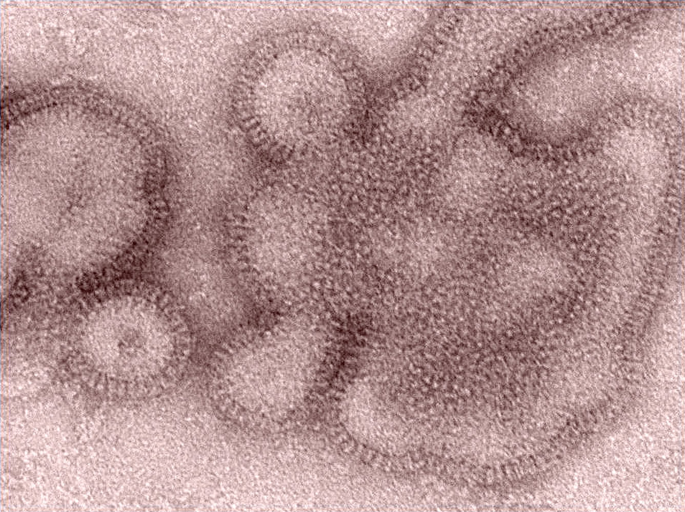 This 2011 image provided by the Centers for Disease Control and Prevention shows an H3N2 influenza virus _ the same type of flu that's responsible for most flu illnesses this winter.