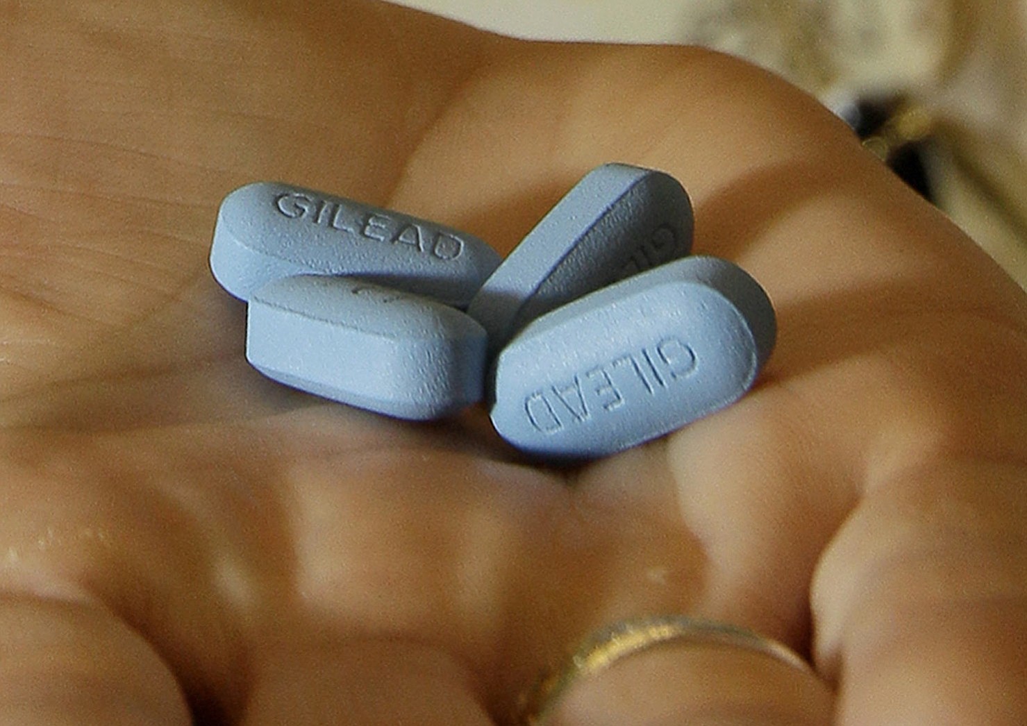 Truvada, used to treat HIV infection, also can help prevent it when taken before and after risky sex by gay men.