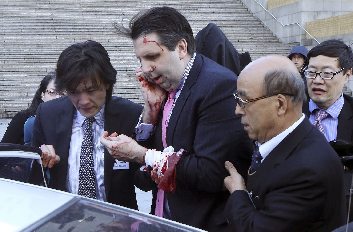 U.S. Ambassador to South Korea Mark Lippert, center, gets into a car to leave for a hospital in Seoul, South Korea, Thursday, March 5, 2015 after being attacked by a man. Lippert was slashed on the face and wrist by a man wielding a blade and screaming that the rival Koreas should be unified, South Korean police said Thursday.