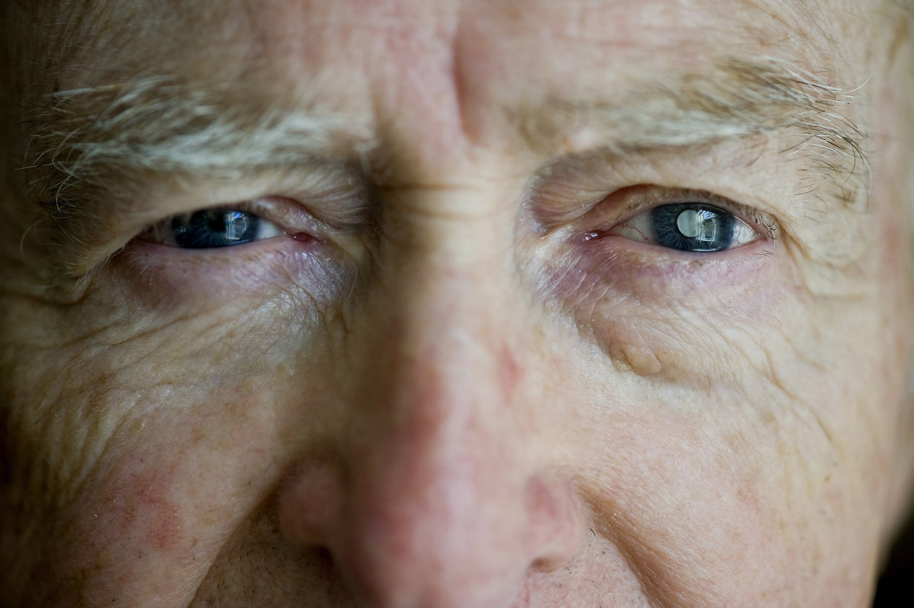 Dan Dunbar, 82, has age-related macular degeneration.