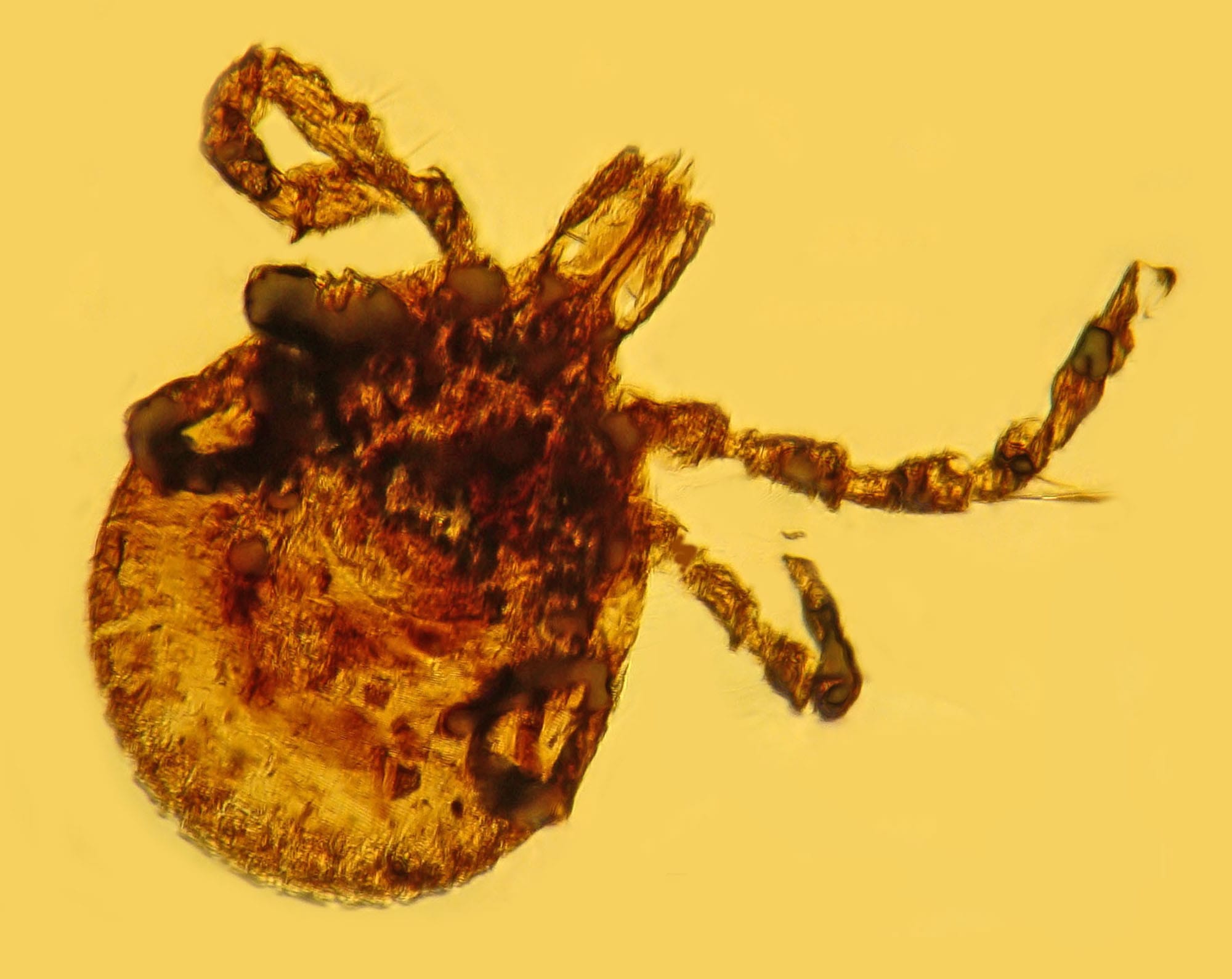 Oregon State University
An ancient fossilized tick contains bacteria similar to the ones that cause Lyme disease. Findings by George Poinar Jr. published in the journal Historical Biology in April indicate that the tick-borne disease probably existed long before there were people to get it.