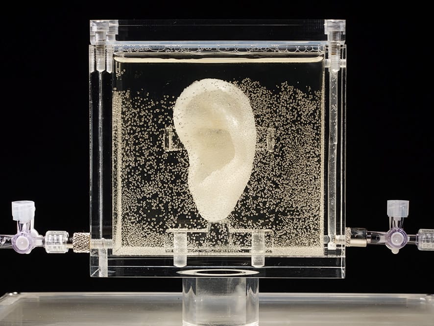An ear made of human cells grown from samples provided by a distant relative of Dutch artist Vincent van Gogh is on display at the center for art and media in Karlsruhe, Germany.