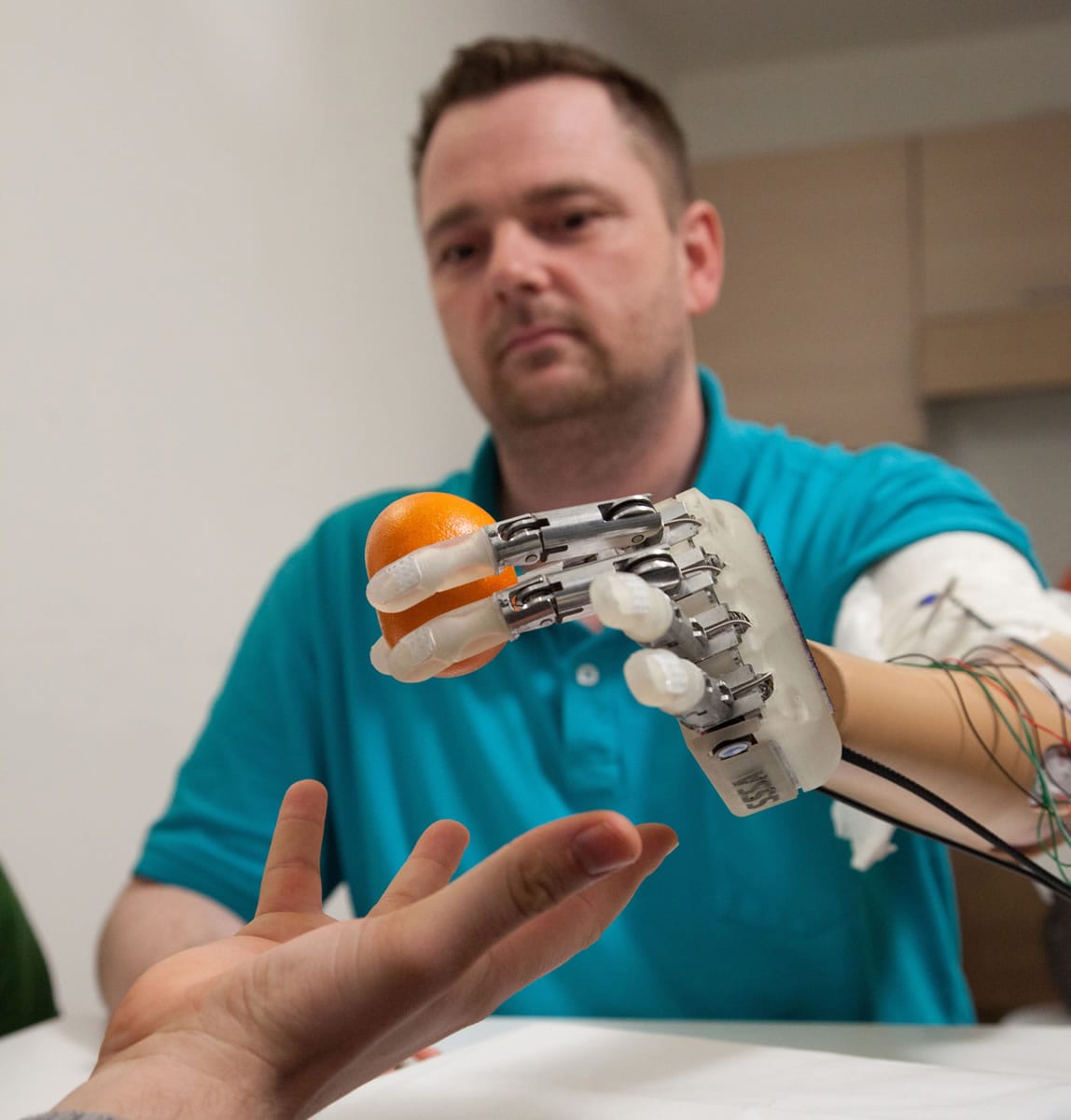 Amputee Dennis Aabo Sorensen holds an orange while wearing sensory feedback-enabled prosthesis in Rome.