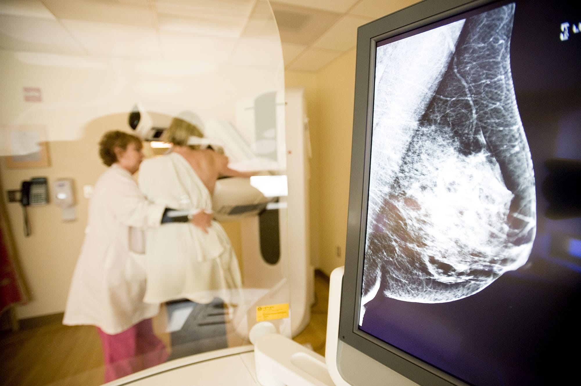 Leslie Dykman, lead mammography technologist at PeaceHealth Southwest Medical Center's Kearney Breast Center, performs a 3-D mammogram on a patient in March 2012.