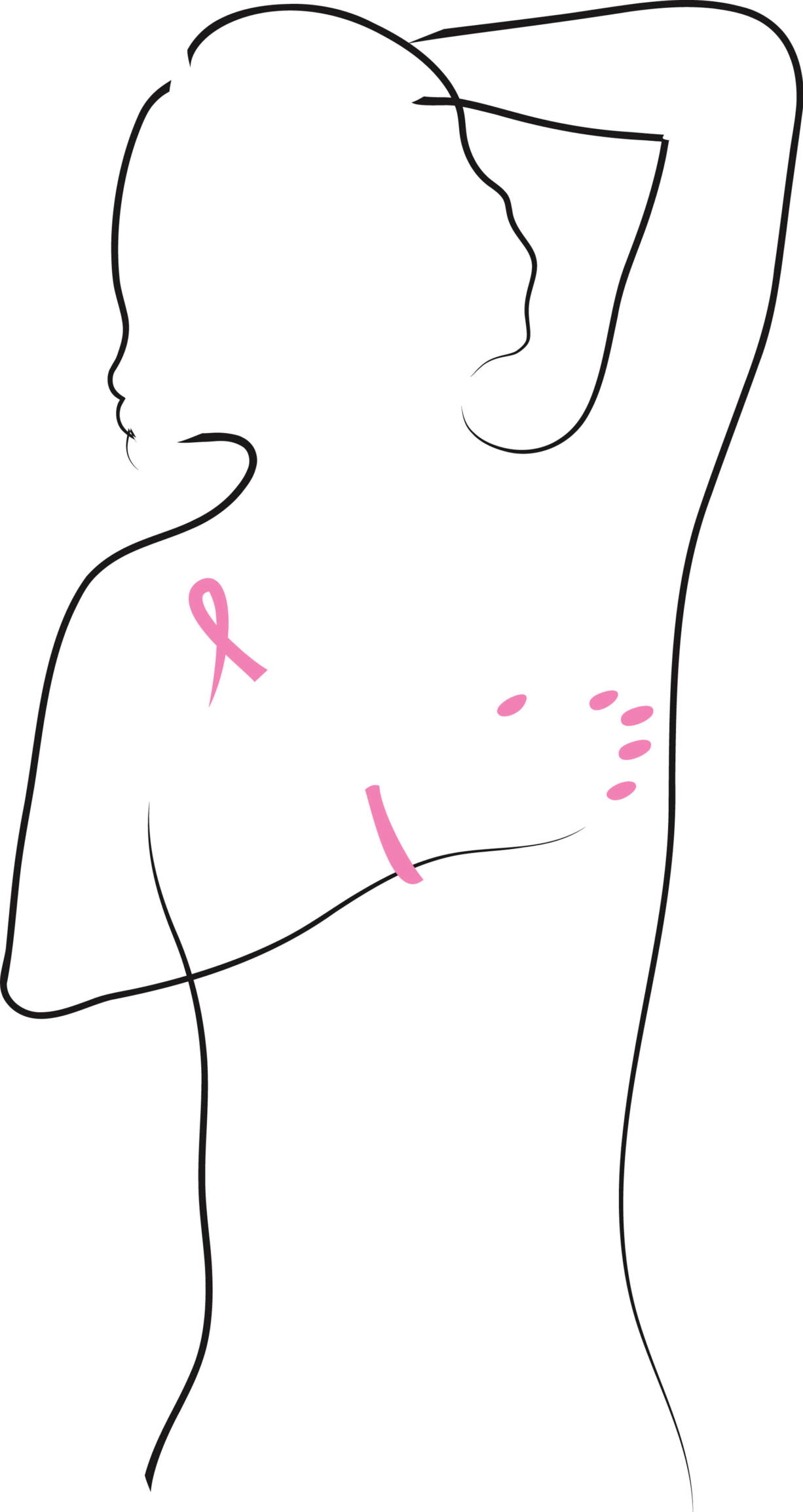 breast clip examination self