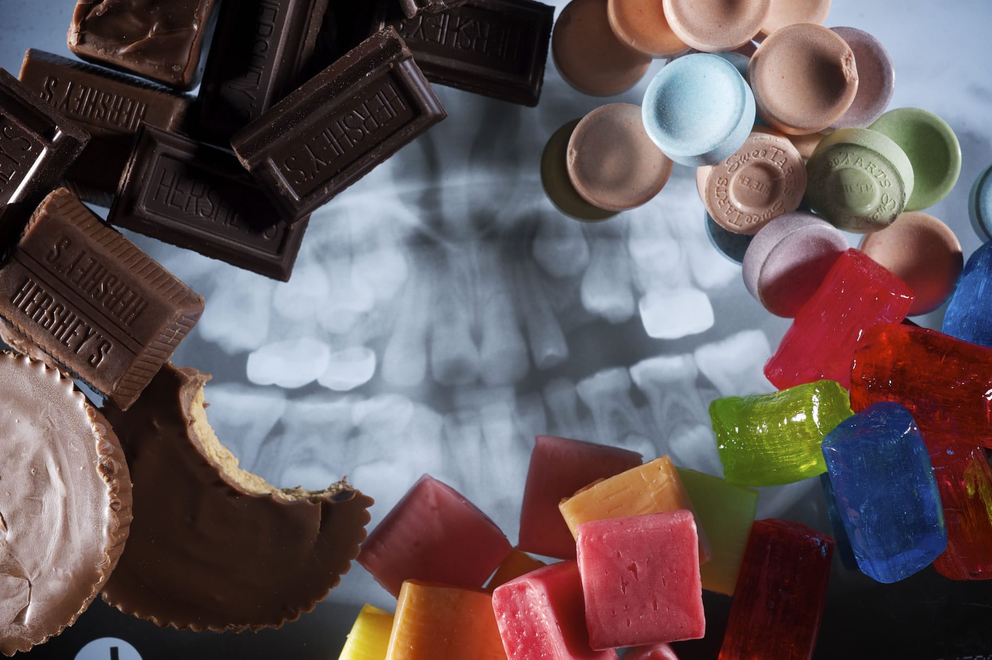 Steven Lane/The Columbian
As Halloween approaches, dentists explain why overindulging on candy isn't such a great idea. They also provide tips for minimizing sugar damage to teeth.