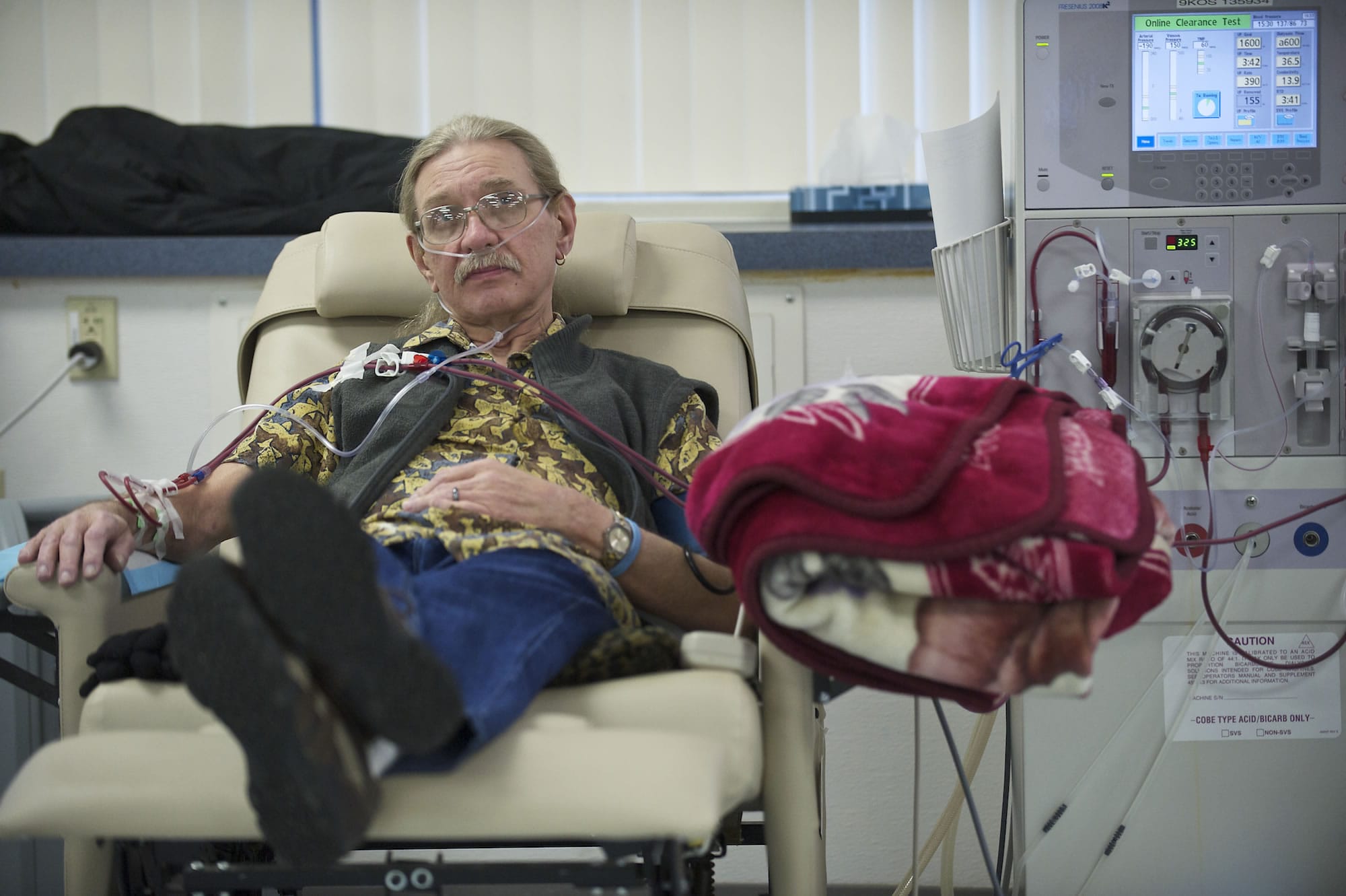 Larry Sperry watches television to help pass the four hours while he receives dialysis at Fresenius in Salmon Creek in January.