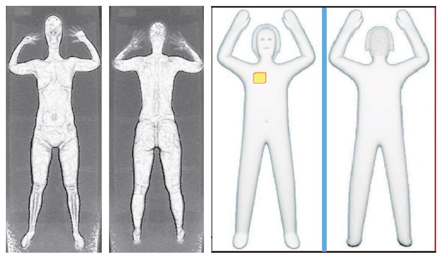 Transportation Security Administration
At left are two images using backscatter advanced image X-ray technology. At right are images from new scanners using new millimeter-wave technology that produces a cartoonlike outline rather than naked images of passengers produced by using X-rays.
