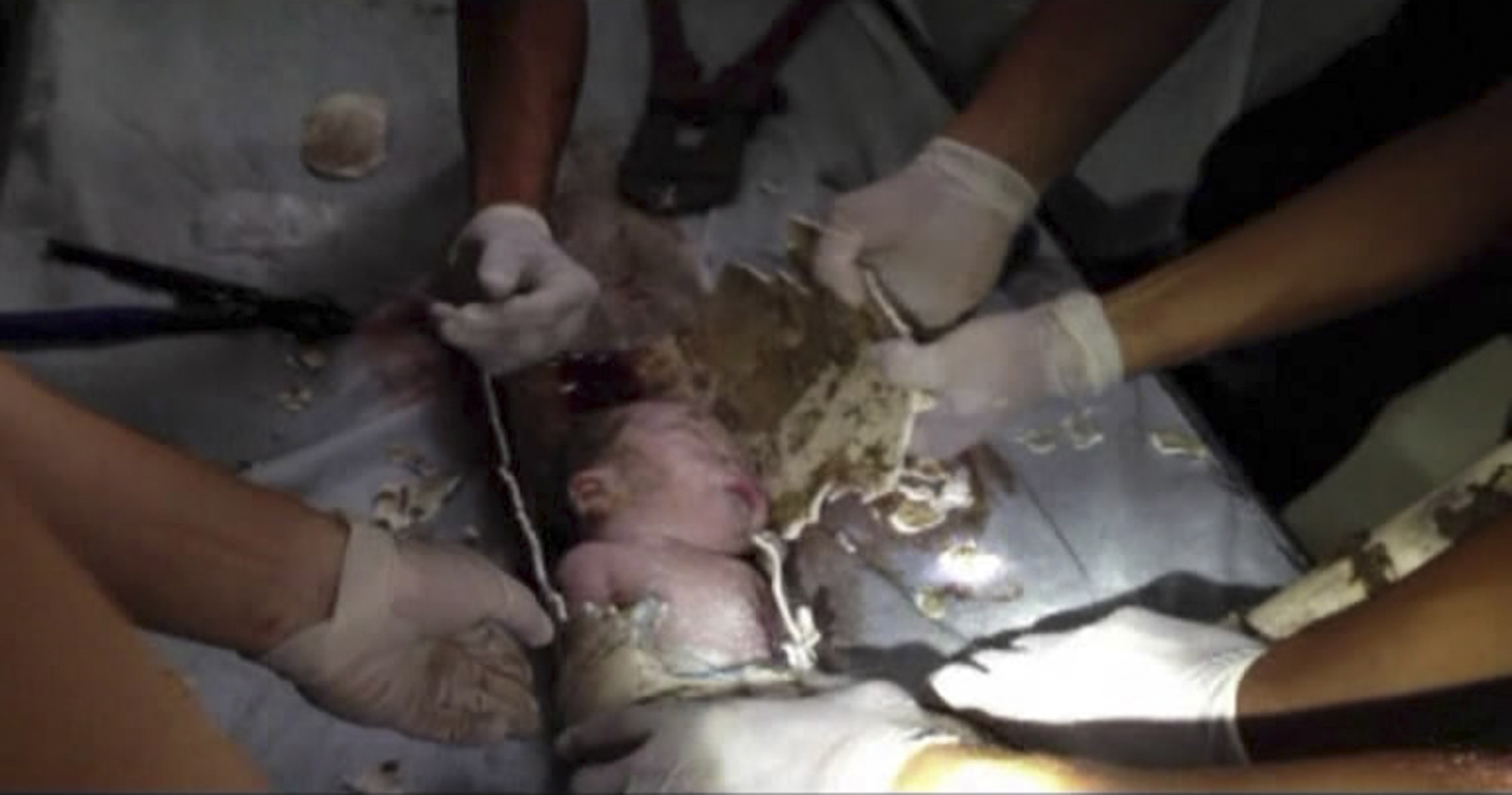In this still image taken from video from Saturday May 25, rescue workers cut away the section of a sewage pipe where a newborn baby was trapped in Pujiang in east China's Zhejiang province.