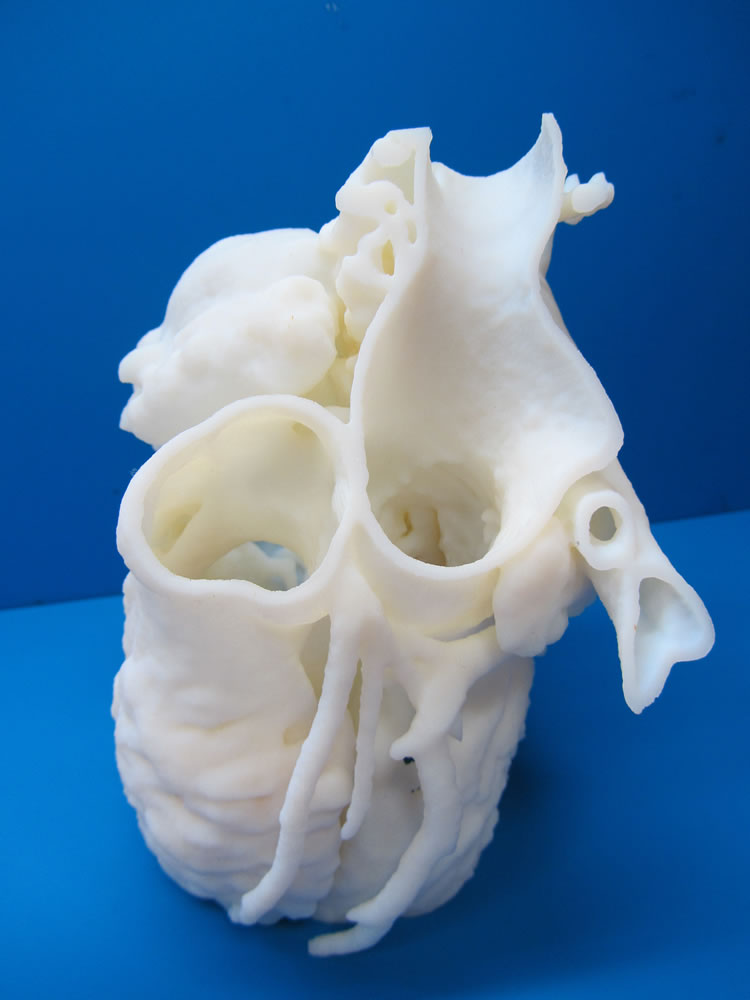 The 3-D printer at Children's National Medical Center created this heart model. Though the technology has great possibilities, it is expensive.
