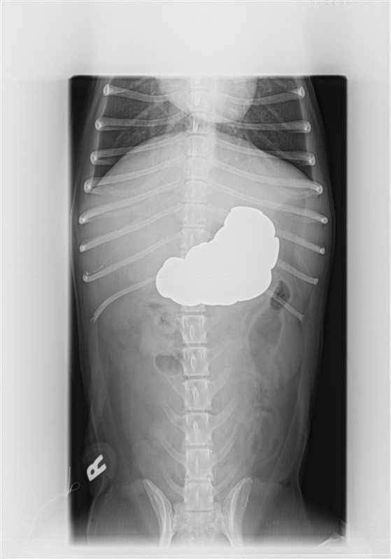 An X-ray of Jack, a dog who swallowed a pile of pennies in March.