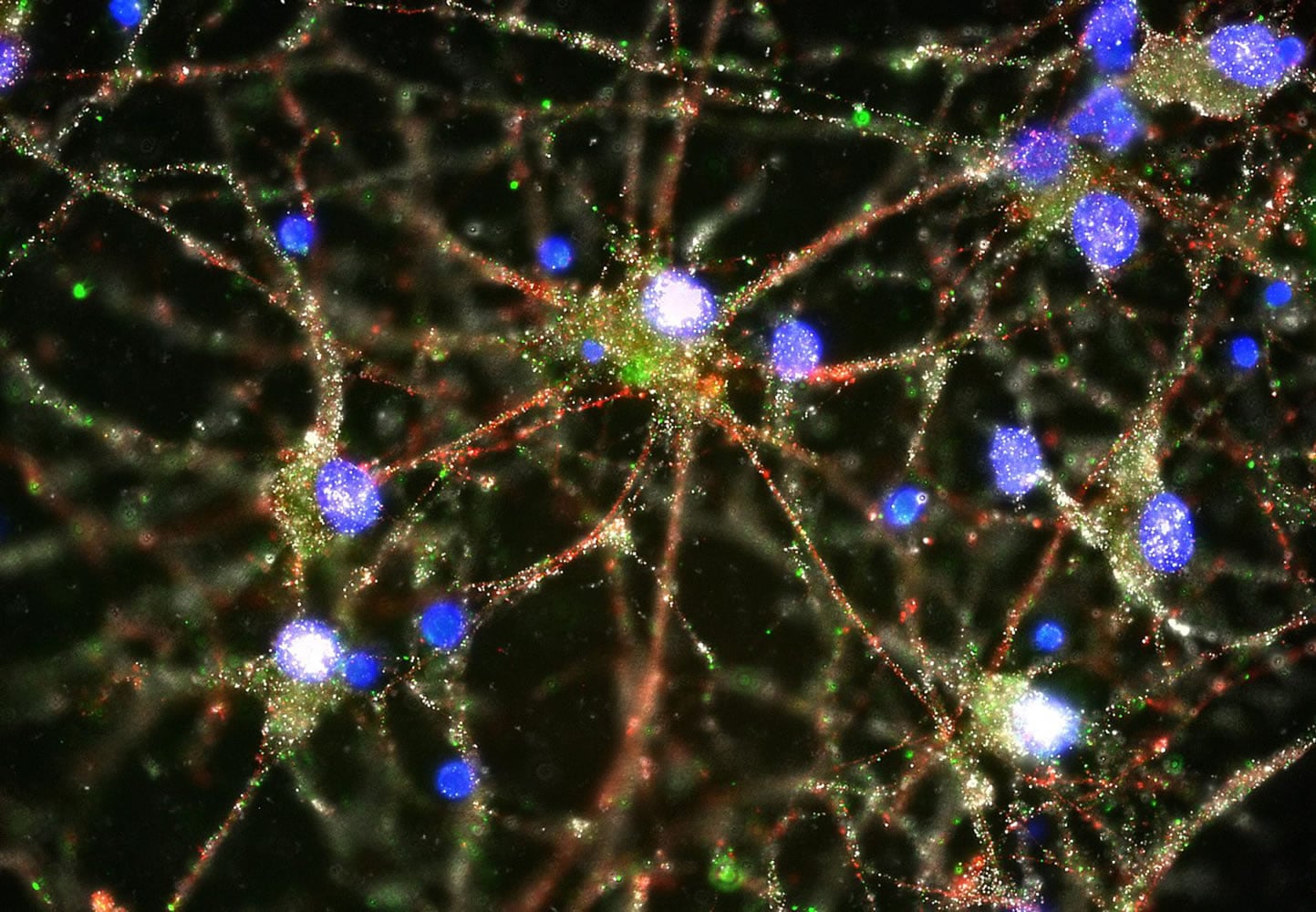 This image provided by Heather de Rivera and made with a fluorescent microscope shows C4 proteins, green, located at the synapses in a culture of human neurons. In research released on Wednesday, Jan. 27, 2016, scientists pursuing the biological roots of schizophrenia have zeroed in on a potential factor _ a normal brain process that gets kicked into overdrive. The finding could someday lead to ways to treat the disease or even prevent it.