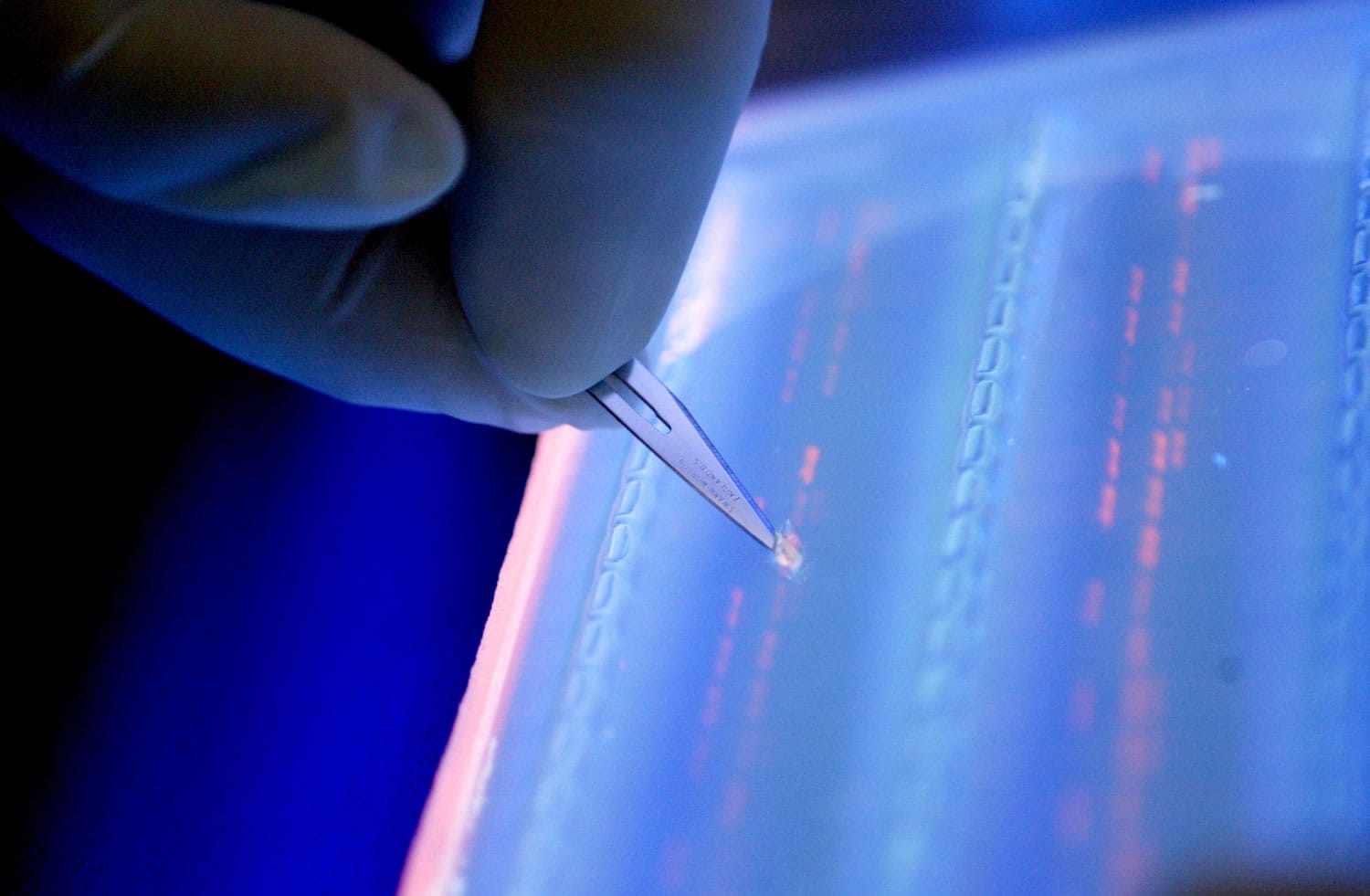 A lab officer cuts a DNA fragment under UV light from an agarose gel for DNA sequencing as part of research to determine genetic mutation in a blood cancer patient. New research shows a sharp escalation in the weapons race against cancer, with several high-tech approaches long dreamed of but not possible or successful until now.