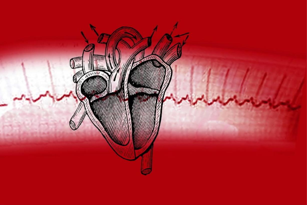 Сердцебиение остановилось. Сердце остановилось. Остановка сердца картинки. Смерть на ЭКГ.