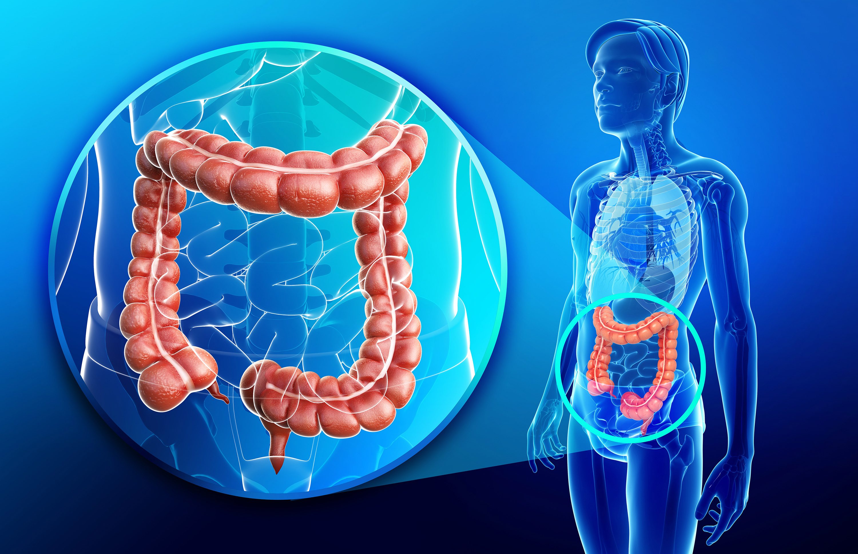 Roughly 140,000 people are diagnosed with colorectal cancer in the United States each year.