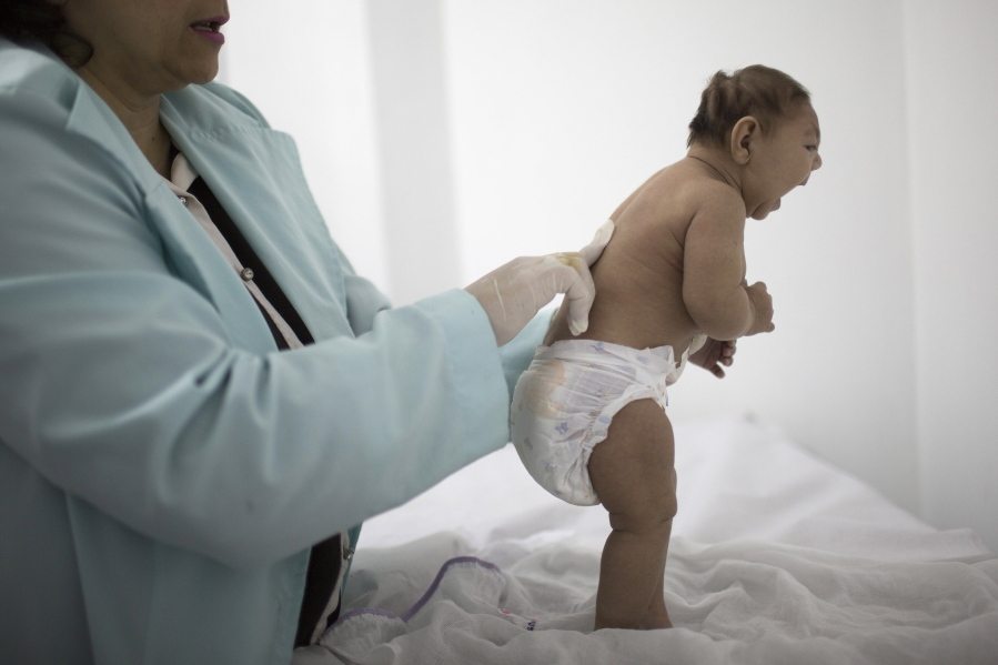 Lara, who was born with microcephaly, is examined in February by a neurologist at the Pedro I hospital in Campina Grande, Brazil. She was less than 3 months old at the time.