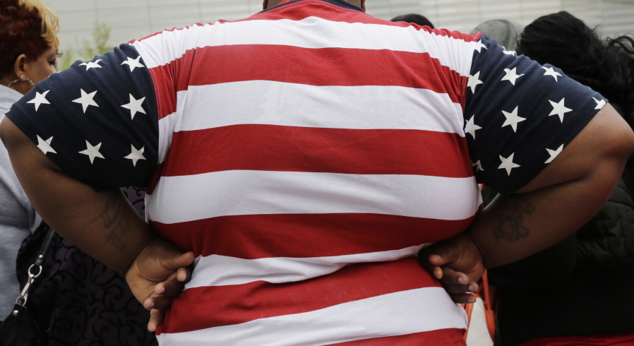 An overweight person is seen in New York. International diabetes organizations are calling for weight-loss surgery to become a more routine treatment option for diabetes, even for some patients who are only mildly obese. Obesity and Type 2 diabetes are a deadly pair, and numerous studies show stomach-shrinking operations can dramatically improve diabetes.