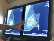 FILE - In this Tuesday, July 31, 2012 file photo, a radiologist compares an image from earlier, 2-D technology mammogram to the new 3-D Digital Breast Tomosynthesis mammography in Wichita Falls, Texas. The technology can detect much smaller cancers earlier. A study released Wednesday, Oct. 12, 2016 questions the value of mammograms for breast cancer screening. It concludes that a woman is more likely to be diagnosed with a tumor that is not destined to become large, and presumably more life-threatening, than she is to have earlier detection of one that is.