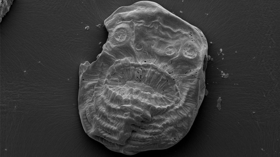 The fossil of Saccorhytus, a microscopic, bag-like sea creature that lived about 540 million years ago. It is the oldest known ancestor of humans.