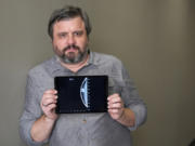 Dalton holds an iPad displaying an image of his mammogram in downtown Los Angeles.