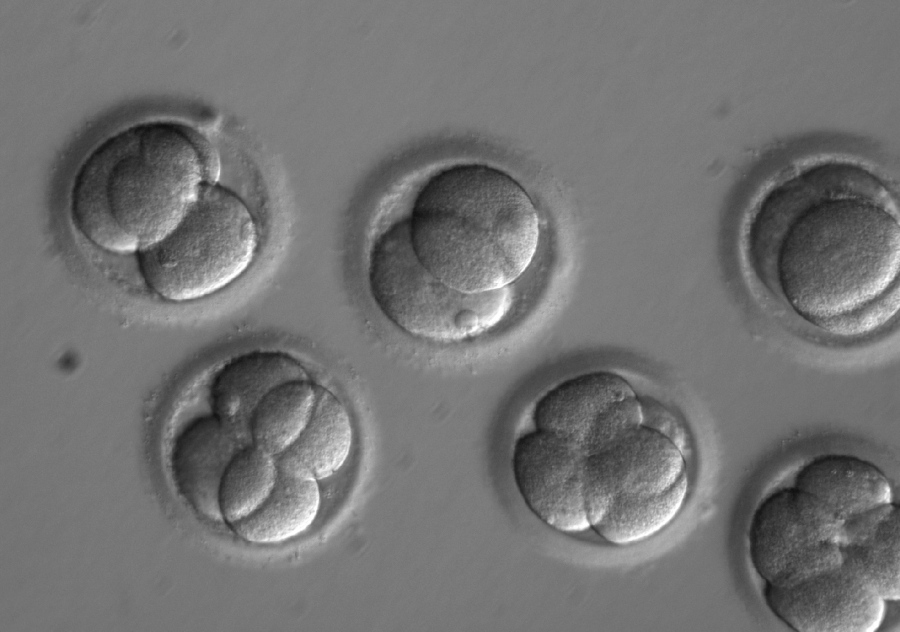 In this photo provided by Oregon Health & Science University, taken through a microscope, human embryos grow in a laboratory for a few days after researchers used gene editing technology to successfully repair a heart disease-causing genetic mutation. The work, a scientific first led by researchers at Oregon Health & Science University, marks a step toward one day preventing babies from inheriting diseases that run in the family.