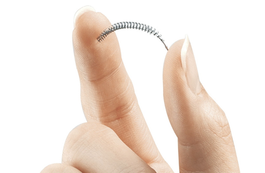 FILE - This image provided by Bayer Healthcare Pharmaceuticals shows the birth control implant Essure. On Friday, July 20, 2018, the maker of the permanent contraceptive implant subject to thousands of injury reports from women and repeated safety restrictions by U.S. regulators says it will stop selling the device at the end of the year due to weak sales.