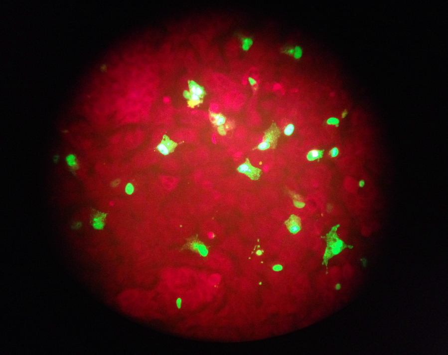 FILE - In this Feb. 26, 2015 photo taken through the eyepiece of a microscope, human cells infected with the flu virus glow green under light from a fluorescence microscope at a laboratory in Seattle. The U.S. government estimates that 80,000 Americans died of flu and flu complications in the winter of 2017-2018 - the highest flu-related death toll in at least four decades. (AP Photo/Ted S.