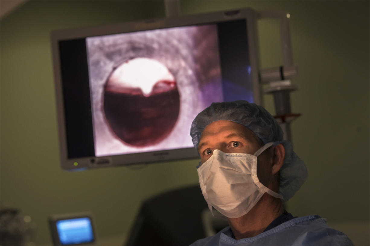 Dr. Scott Rushing, the medical director of PeaceHealth Southwest’s GYN/oncology services, monitors the insertion of an instrument during his 1,000th robotic surgery at PeaceHealth Southwest Medical Center in Vancouver. Rushing is one of three to four active Northwest surgeons in his field to have completed 1,000 robotic surgeries.