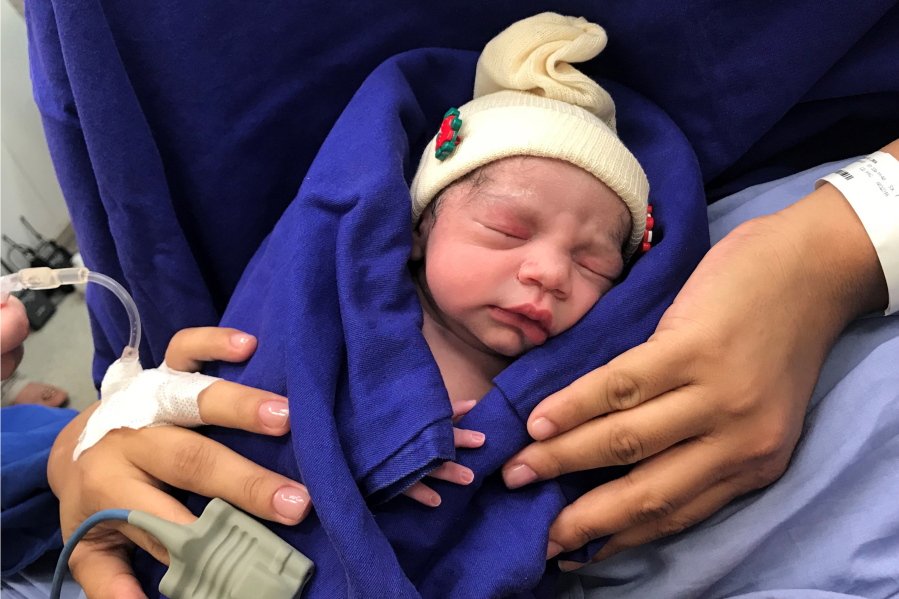 This Dec. 15, 2017 photo provided by transplant surgeon Dr. Wellington Andraus shows the baby girl born to a woman with a uterus transplanted from a deceased donor at the Hospital das Clinicas of the University of Sao Paulo School of Medicine, Sao Paulo, Brazil, on the day of her birth. Nearly a year later, mother and baby are both healthy. (Courtesy Dr.
