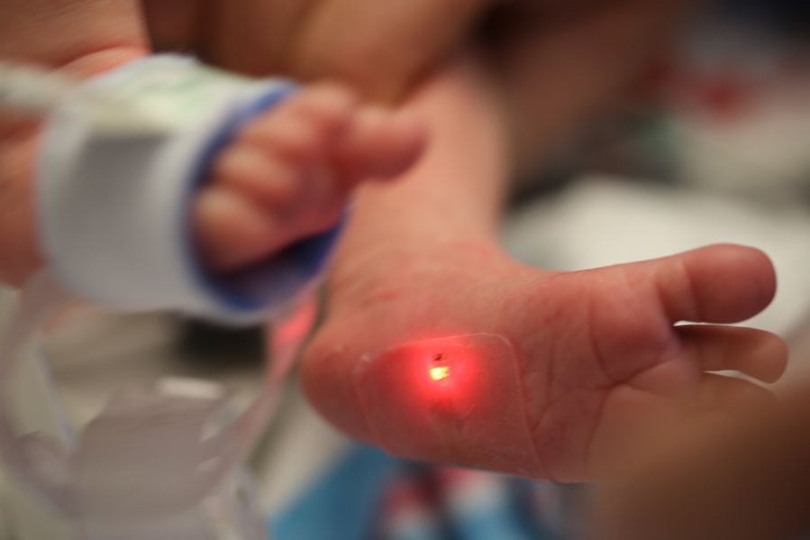 A soft, flexible wireless sensor is applied on the foot of a baby involved in a clinical trial at Ann & Robert H. Lurie Children’s Hospital of Chicago. This kind of sensor could replace the tangle of wire-based sensors that currently monitor babies in neonatal intensive care units.