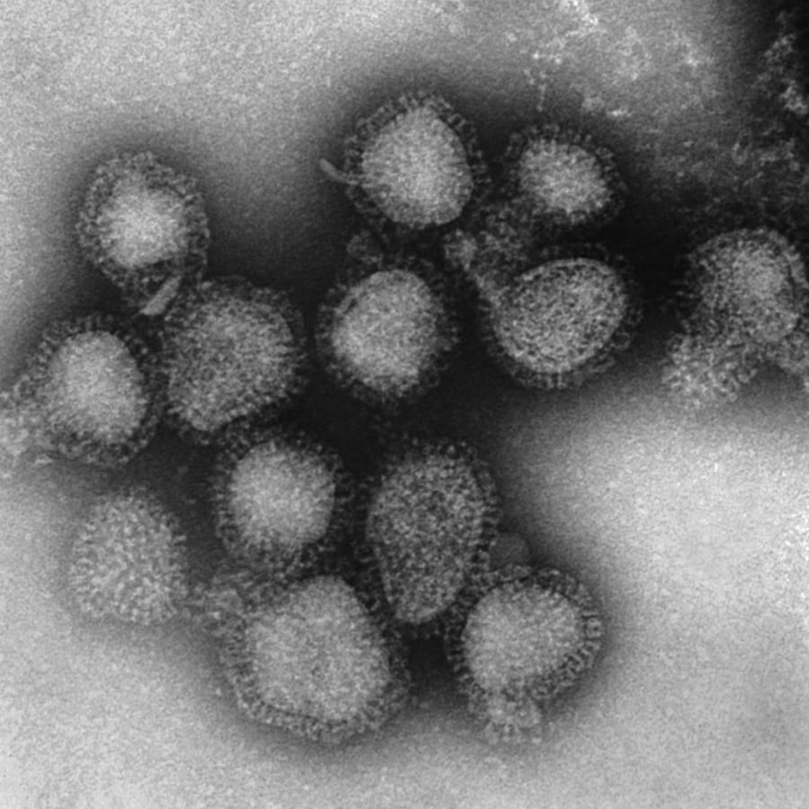 CDC: 64 flu-related child deaths so far this season