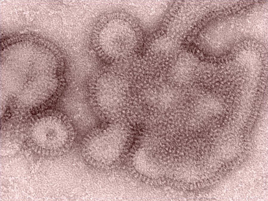 FILE - This 2011 electron microscope image provided by the Centers for Disease Control and Prevention shows H3N2 influenza virions. In January 2019, the flu season was shaping up to be one of the shortest and mildest in recent U.S. history. But a surprising second viral wave has just made it the longest, according to the flu statistics released on Friday, April 19, 2019. (Dr.