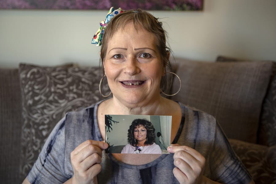 Debra Buckley poses for a portrait as she holds a photo of herself from 1992, which shows her smile prior to dental infections, at her home in Vancouver. Buckley needs to raise $15,000 more to afford dental work that could prevent deadly infections, but she can’t work because of her medical complications and might not ever be able to afford the treatment.
