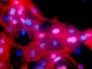 FILE - This undated fluorescence-colored microscope image made available by the National Institutes of Health in September 2016 shows a culture of human breast cancer cells. On Tuesday, Aug. 20, 2019, the U.S. Preventive Services Task Force recommended more women should consider gene testing for hereditary breast or ovarian cancer, especially those who’ve already survived cancer once.