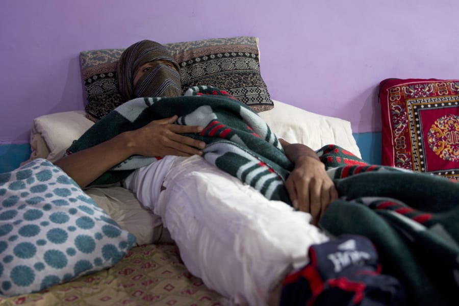 A Kashmiri boy, who was injured in a protest last week, recovers at his home in Srinagar, Indian controlled Kashmir, Saturday, Aug. 17, 2019. Authorities began restoring landline phone services on Saturday after a nearly two-week security crackdown and news blackout following a decision to downgrade the majority-Muslim region’s autonomy.