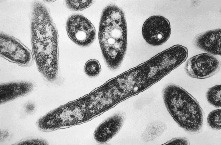 This 1978 electron microscope image made available by the Centers for Disease Control and Prevention shows Legionella pneumophila bacteria which are responsible for causing the pneumonic disease Legionnaires’ disease. In a report released Wednesday, Aug. 14, 2019, the National Academies of Sciences, Engineering and Medicine said annual cases of Legionnaires’ jumped more than fivefold from 2000 to 2017, and that as many as 70,000 Americans get the disease every year. High-profile recent outbreaks occurred in Atlanta and Flint, Michigan.