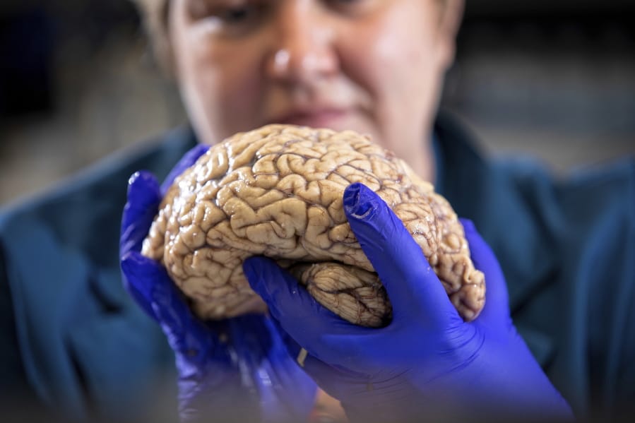 In this Aug. 14, 2019 photo provided by the University of Kentucky, Donna Wilcock, of the Sanders-Brown Center on Aging, holds a brain in her lab in Lexington, Ky.
