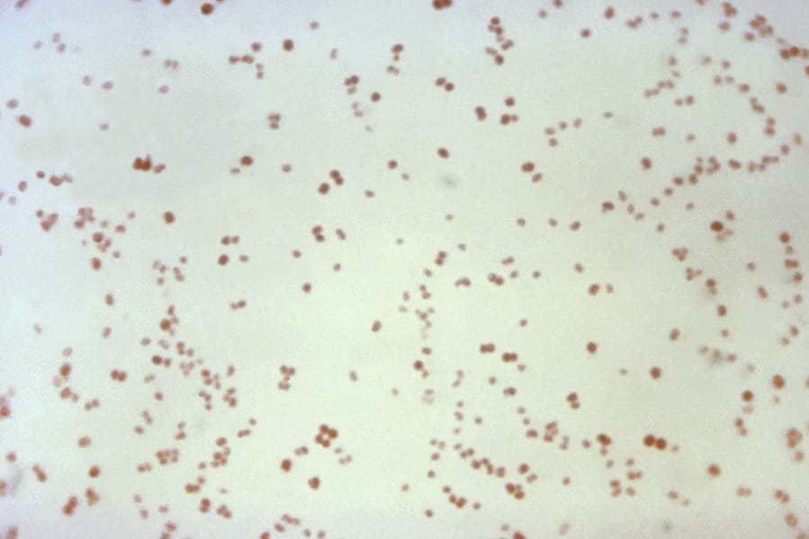 This 1971 microscope image made available by the Centers for Disease Control and Prevention shows Neisseria gonorrhoeae bacteria, which causes the sexually transmitted disease gonorrhea. In a report released Wednesday, Nov. 13, 2019, the Centers for Disease Control and Prevention estimated about 36,000 Americans died from drug-resistant infections in 2017 -- down about 18% from an estimated 44,000 in 2013. Though deaths may be going down, non-fatal infections increased nationally from 2013 to 2017, from 2.6 million to 2.8 million. Dramatic increases in drug-resistant gonorrhea, urinary tract infections, and group A strep were largely to blame.