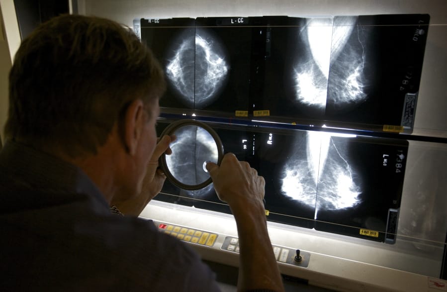 FILE - In this May 6, 2010 file photo, a radiologist checks mammograms in in Los Angeles. Women who use certain types of hormones after menopause still have an increased risk of developing breast cancer nearly two decades after they stop taking the pills, long-term results from a big federal study suggest.