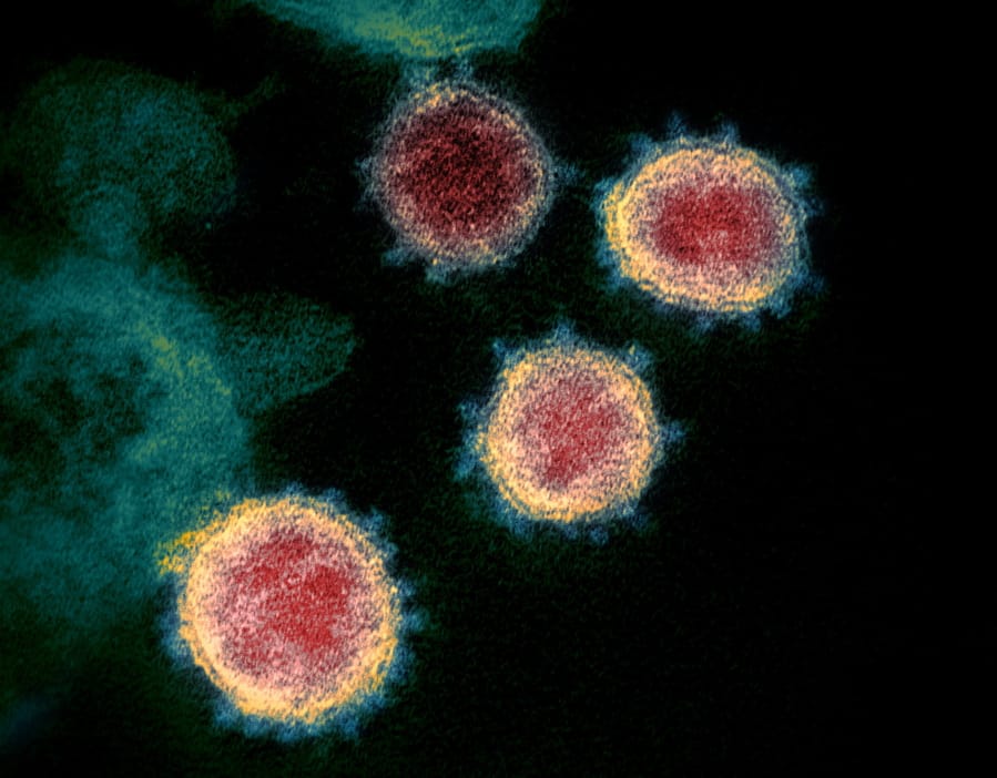 This undated electron microscope image made available by the U.S. National Institutes of Health in February 2020 shows the coronavirus that causes COVID-19. The sample was isolated from a patient in the U.S.