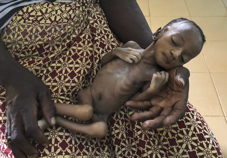 One-month old Haboue Solange Boue, awaiting medical care for severe malnutrition, is held by her mother, Danssanin Lanizou, 30, at the feeding center of the main hospital in the town of Hounde, Tuy Province, in southwestern Burkina Faso on Thursday, June 11, 2020. With the markets closed because of coronavirus restrictions, her family sold fewer vegetables. Lanizou is too malnourished to nurse her.
