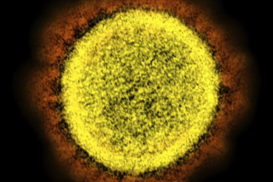 FILE - This 2020 electron microscope image made available by the National Institute of Allergy and Infectious Diseases shows a Novel Coronavirus SARS-CoV-2 particle isolated from a patient, in a laboratory in Fort Detrick, Md. Coronaviruses, including the newest one, are named for the spikes that cover their outer surface like a crown, or corona in Latin. Using those club-shaped spikes, the virus latches on to the outer wall of a human cell, invades it and replicates, creating viruses to hijack more cells.