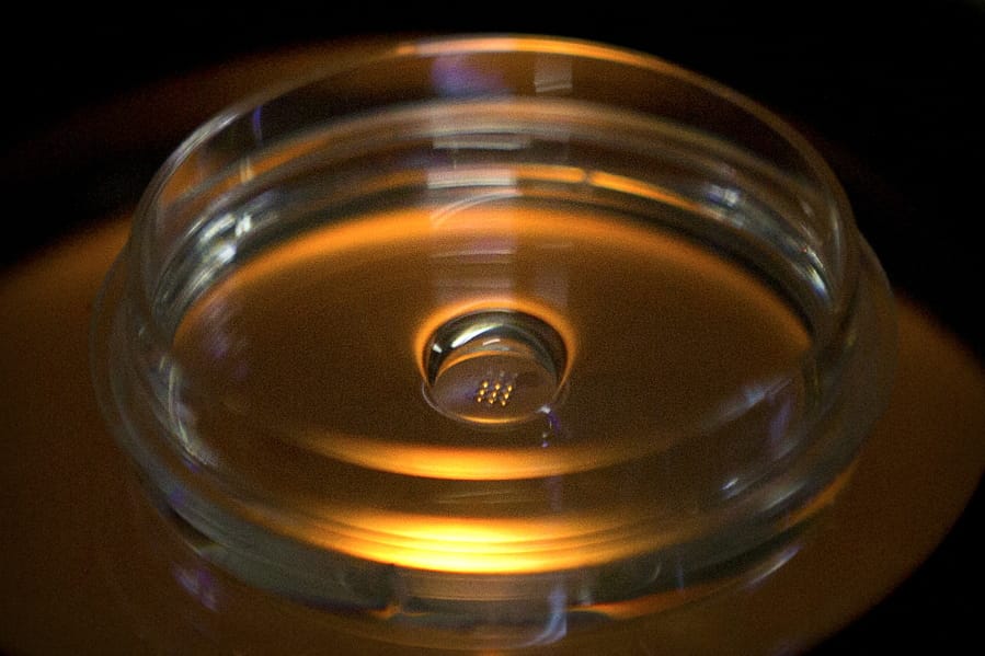 A lab dish containing embryos that have been injected with Cas9 protein and PCSK9 sgRNA is seen in a laboratory in Shenzhen in southern China&#039;s Guangdong province.